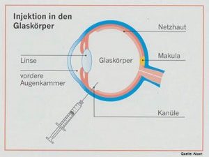 Schematische Darstellung des Auges